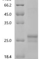Human Platelet-derived growth factor subunit B (PDGFB) Recombinant Protein, N-His/C-His - BioCrest Sci