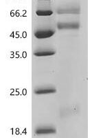 Macaca mulatta Coagulation factor X Recombinant Protein - BioCrest Sci