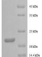 Human Granulocyte colony-stimulating factor protein (CSF-3), partial Recombinant Protein - BioCrest Sci