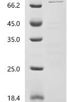 Human Heterogeneous nuclear ribonucleoprotein D0 (HNRNPD) Recombinant Protein - BioCrest Sci