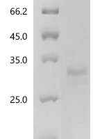 Plasmodium falciparum Thrombospondin-related anonymous protein (TRAP), partial Recombinant Protein, C-His, aa 26–287, Yeast - BioCrest Sci