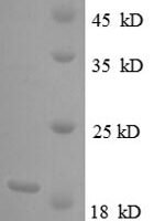 Bovie Tumor necrosis factor (TNF), partial Recombinant Protein, N-His - BioCrest Sci