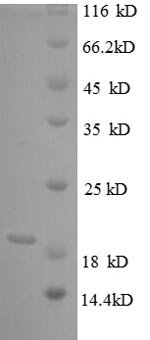 Bovie Tumor necrosis factor (TNF), partial Recombinant Protein, N-His, Bos taurus (Bovine), E.coli, N-terminal 6xHis-tagged, 21.4 kDa, purity >≥ 90% as determined by SDS-PAGE.