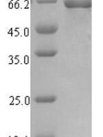 Escherichia coli Uncharacterized protein YihF (yihF) Recombinant Protein - BioCrest Sci