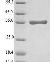 Human Sodium/potassium-transporting ATPase subunit gamma (FXYD2) Recombinant Protein - BioCrest Sci