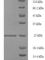 Human Resistin (RETN) Recombinant Protein - BioCrest Sci