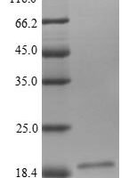 Human Low-density lipoprotein receptor-related protein 4 (LRP4), partial Recombinant Protein, N-His-tagged/Tag-Free - BioCrest Sci
