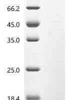 Human Taste receptor type 2 member 14 (TAS2R14), partial Recombinant Protein - BioCrest Sci