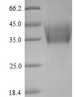 Newcastle disease virus Hemagglutinin-neuraminidase (HN), partial Recombinant Protein, N-His/C-Myc - BioCrest Sci