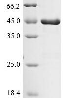 Porphyromonas gingivalis Lys-gingipain W83 (kgp), partial Recombinant Protein - BioCrest Sci