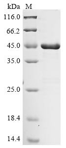 Porphyromonas gingivalis Lys-gingipain W83 (kgp), partial Recombinant Protein, Porphyromonas gingivalis, E.coli, C-terminal 10xHis-tagged, 51.6 kDa, purity >≥ 90% as determined by SDS-PAGE.