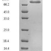 Mouse Mannan-binding lectin serine protease 2 (Masp2) Recombinant Protein, N-His - BioCrest Sci