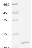 Human Uncharacterized protein C1orf54 (C1orf54) Recombinant Protein, C-His - BioCrest Sci
