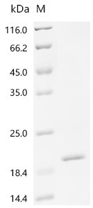 Human Uncharacterized protein C1orf54 (C1orf54) Recombinant Protein, C-His, Homo sapiens (Human), E.coli, C-terminal 6xHis-tagged, 14.2 kDa, purity >≥ 90% as determined by SDS-PAGE.