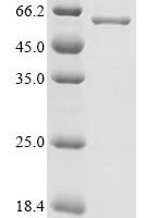 Human Lanosterol 14-alpha demethylase (CYP51A1), partial Recombinant Protein - BioCrest Sci