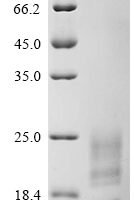 Camelpox virus A27L membrane protein (A27L) Recombinant Protein - BioCrest Sci