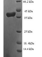 Human Elongin-C (ELOC) Recombinant Protein - BioCrest Sci