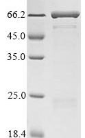 Enterobacteria phage T4 Fibritin (wac) Recombinant Protein - BioCrest Sci