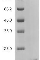 Plutella maculipennis NADH dehydrogenase [ubiquinone] 1 beta subcomplex subunit 9, partial Recombinant Protein - BioCrest Sci