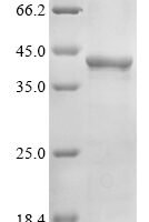 Human BMP-2-inducible protein kinase (BMP2K), partial Recombinant Protein - BioCrest Sci