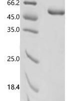 Human Selenoprotein P (SELENO) Recombinant Protein - BioCrest Sci