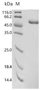 Human Selenoprotein P (SELENO) Recombinant Protein, Homo sapiens (Human), E.coli, C-terminal 6xHis-tagged, 47.5 kDa, purity >≥ 85% as determined by SDS-PAGE.