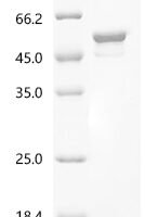 Coccidioides immitis Endochitinase 1 (CTS1) Recombinant Protein, C-His, aa 18–427, E.coli - BioCrest Sci