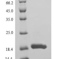 Drosophila melanogaster Ubiquitin-conjugating enzyme E2-17 kDa (UbcD6) Recombinant Protein, N-His - BioCrest Sci