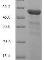 Human Inositol polyphosphate-5-phosphatase A (INPP5A) Recombinant Protein - BioCrest Sci