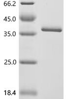 Epstein-Barr virus Lytic switch protein BZLF1 (BZLF1) Recombinant Protein, C-His - BioCrest Sci