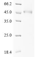 Human Prostatic acid phosphatase (ACP3), partial Recombinant Protein, C-10His, aa 33–382, Yeast - BioCrest Sci
