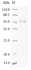 Human Prostatic acid phosphatase (ACP3), partial Recombinant Protein, C-10His, aa 33–382, Yeast, Homo sapiens (Human), Yeast, C-terminal 10xHis-tagged, 42.7 kDa, purity >≥ 90% as determined by SDS-PAGE.