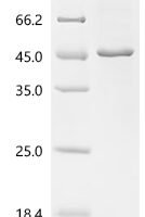 Human Leucine-rich repeat-containing protein 28 (LRRC28) Recombinant Protein - BioCrest Sci