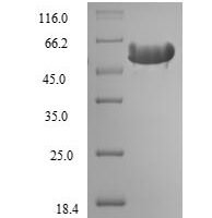 Rat Hemopexin (Hpx) Recombinant Protein, N-His, aa 24–460, E.coli - BioCrest Sci