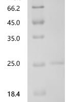 Mouse Prolactin (Prl) Recombinant Protein, C-10His - BioCrest Sci