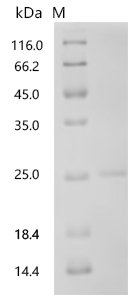 Mouse Prolactin (Prl) Recombinant Protein, C-10His, Mus musculus (Mouse), Mammalian cell, C-terminal 10xHis-tagged, 23.8 kDa, purity >≥ 90% as determined by SDS-PAGE.