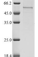 Human COMM domain-containing protein 5 (COMMD5) Recombinant Protein, C-hFc1 - BioCrest Sci