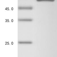 Avian infectious bronchitis virus Nucleoprotein (N) Recombinant Protein, C-His, aa 1–409, strain Gray - BioCrest Sci
