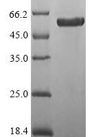 Mouse Protein Wnt-7b (Wnt7b) Recombinant Protein, N-10His-SUMO/C-Myc - BioCrest Sci