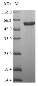 Mouse Protein Wnt-7b (Wnt7b) Recombinant Protein, N-10His-SUMO/C-Myc, Mus musculus (Mouse), E.coli, N-terminal 10xHis-SUMO-tagged and C-terminal Myc-tagged, 56.3 kDa, purity >≥ 85% as determined by SDS-PAGE.