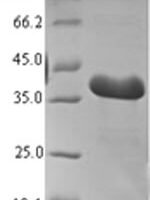 Mouse Thyroid hormone-inducible hepatic protein (Thrsp) Recombinant Protein - BioCrest Sci
