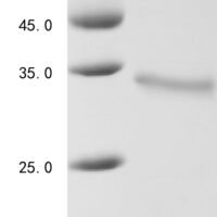 Human Osteopontin (SPP1) Recombinant Protein - BioCrest Sci