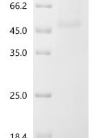 Human Adipocyte plasma membrane-associated protein (APMAP), partial Recombinant Protein, C-10His - BioCrest Sci