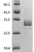 Mouse Angiopoietin-1 (Angpt1), partial Recombinant Protein - BioCrest Sci