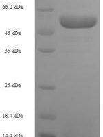 Human Squamous cell carcinoma antigen recognized by T-cells 3 (SART3), partial Recombinant Protein, N-His-SUMO - BioCrest Sci