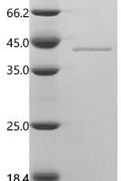 Escherichia coli Histidine biosynthesis bifunctional protein HisB (hisB) Recombinant Protein - BioCrest Sci