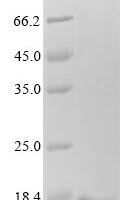 Danio rerio Transthyretin (TTR) Recombinant Protein - BioCrest Sci