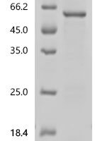 Human LIM domain-binding protein 1(LDB1) Recombinant Protein - BioCrest Sci