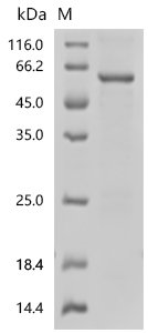Human LIM domain-binding protein 1(LDB1) Recombinant Protein, Homo sapiens (Human), E.coli, C-terminal 6xHis-tagged, 53.3 kDa, purity >≥ 85% as determined by SDS-PAGE.