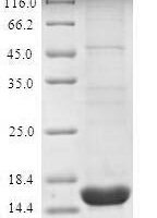 Human Sodium-dependent phosphate transport protein 2B (SLC34A2), partial Recombinant Protein, N-His - BioCrest Sci